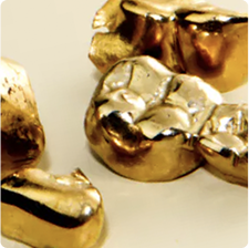 Dentalgold